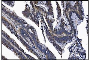 IHC analysis of KCNQ2 using anti-KCNQ2 antibody (ABIN7601522).