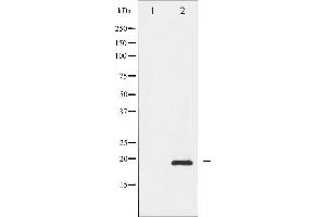 Western blot analysis of Survivin phosphorylation expression in A549 whole cell lysates,The lane on the left is treated with the antigen-specific peptide. (Survivin 抗体  (pThr117))