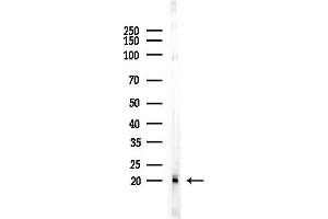 anti-Ribosomal Protein L29 (RPL29) (Internal Region) antibody
