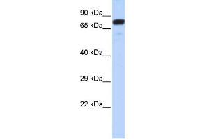 WB Suggested Anti-ZNF221 Antibody Titration:  0. (ZNF221 抗体  (N-Term))