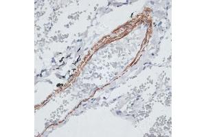Immunohistochemistry (IHC) image for anti-Tropomyosin 1 (Alpha) (TPM1) (AA 1-245) antibody (ABIN3021578)