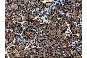 Immunohistochemical staining of paraffin-embedded Human Kidney tissue using anti-EPHX2 mouse monoclonal antibody. (EPHX2 抗体)