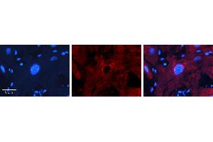 Rabbit Anti-MBD2 Antibody   Formalin Fixed Paraffin Embedded Tissue: Human heart Tissue Observed Staining: Nucleus Primary Antibody Concentration: 1:100 Other Working Concentrations: N/A Secondary Antibody: Donkey anti-Rabbit-Cy3 Secondary Antibody Concentration: 1:200 Magnification: 20X Exposure Time: 0. (MBD2 抗体  (Middle Region))