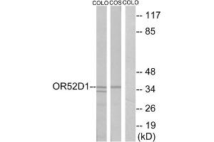 Western blot analysis of extracts from COLO cells and COS cells, using OR52D1 antibody. (OR52D1 抗体  (C-Term))