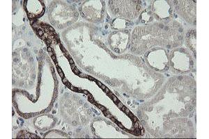 Image no. 9 for anti-Diphthamide Biosynthesis Protein 2 (DPH2) antibody (ABIN1497892)