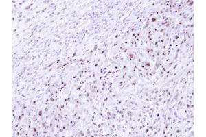 IHC-P Image Immunohistochemical analysis of paraffin-embedded SAS xenograft , using DRAK1, antibody at 1:500 dilution. (STK17A 抗体)