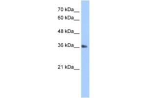 Western Blotting (WB) image for anti-TIMELESS Interacting Protein (TIPIN) antibody (ABIN2463351) (TIPIN 抗体)