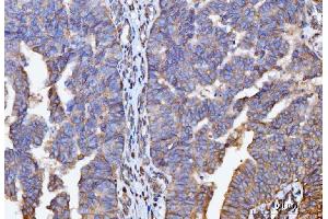 IHC analysis of GNB3 using anti-GNB3 antibody (ABIN7599726).