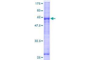 ASB17 Protein (AA 1-295) (GST tag)