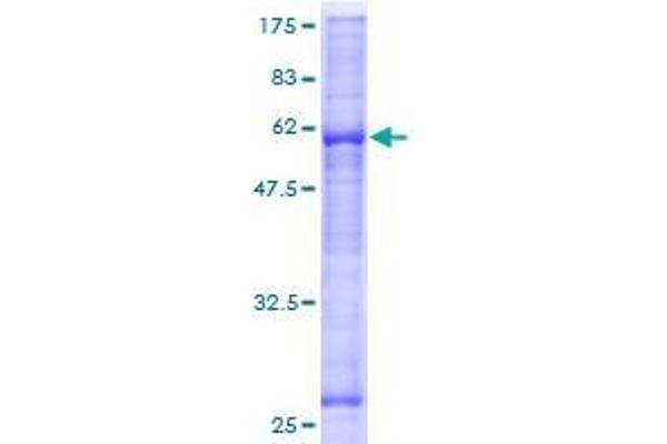 ASB17 Protein (AA 1-295) (GST tag)