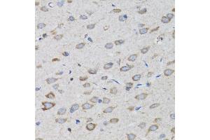 Immunohistochemistry (IHC) image for anti-Proteasome (Prosome, Macropain) 26S Subunit, Non-ATPase, 10 (PSMD10) (AA 1-226) antibody (ABIN1682352)