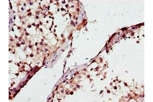Immunohistochemistry of paraffin-embedded human testis tissue using ABIN7163370 at dilution of 1:100 (ATP8A2 抗体  (AA 358-570))