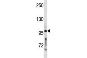 PCSK5 antibody western blot analysis in WiDr lysate. (PCSK5 抗体  (AA 95-124))