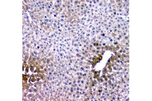 IHC analysis of RMI2 using anti-RMI2 antibody (ABIN6719656). (RMI2 抗体)