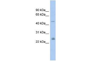 WB Suggested Anti-DMRT3 Antibody Titration: 0. (DMRT3 抗体  (Middle Region))