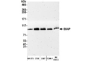 Western Blotting (WB) image for anti-Ubiquitin Protein Ligase E3A (ube3a) (AA 400-450) antibody (ABIN7449675)