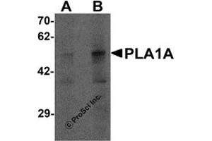 Western Blotting (WB) image for anti-Phospholipase A1 Member A (PLA1A) (C-Term) antibody (ABIN1077384) (PLA1A 抗体  (C-Term))