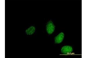 Immunofluorescence of  purified  MaxPab antibody to NS4ATP2 on HeLa cell.