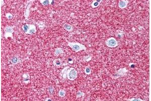 Human Brain, Putamen, Neuropil (formalin-fixed, paraffin-embedded) stained with GAP43 antibody ABIN305762 at 5 ug/ml followed by biotinylated anti-mouse IgG secondary antibody ABIN481714, alkaline phosphatase-streptavidin and chromogen. (GAP43 抗体)
