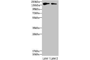 Western blot All lanes: FYCO1 antibody at 2. (FYCO1 抗体  (AA 2-255))