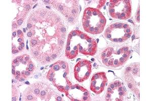 HNF1A antibody was used for immunohistochemistry at a concentration of 4-8 ug/ml. (HNF1A 抗体  (N-Term))