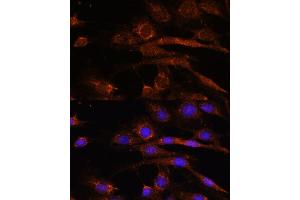Immunofluorescence analysis of C6 cells using S2 antibody (ABIN7265451) at dilution of 1:100. (AP3S2 抗体  (AA 1-193))