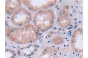 Immunohistochemistry (IHC) image for anti-Fatty Acid Desaturase 2 (FADS2) (AA 1-130) antibody (ABIN7436027)