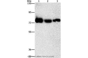 Western blot analysis of Human fetal muscle tissue, K562 and hela cell, using AMPD1 Polyclonal Antibody at dilution of 1:1600 (AMPD1 抗体)