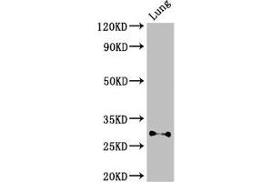 Western Blot Positive WB detected in: Mouse lung tissue All lanes: SPINT2 antibody at 3 μg/mL Secondary Goat polyclonal to rabbit IgG at 1/50000 dilution Predicted band size: 29, 22 kDa Observed band size: 29 kDa (SPINT2 抗体  (AA 71-194))