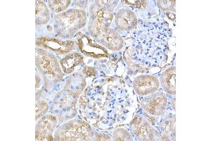 Immunohistochemistry of paraffin-embedded rat kidney using GCN2 Rabbit pAb (ABIN6127829, ABIN6140031, ABIN6140033 and ABIN6216318) at dilution of 1:250 (40x lens). (GCN2 抗体  (AA 1-300))