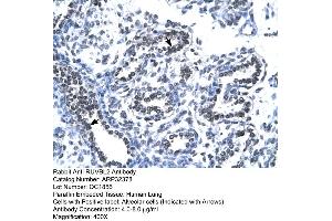 Immunohistochemistry (IHC) image for anti-RuvB-Like 2 (E. Coli) (RUVBL2) (N-Term) antibody (ABIN2779600)