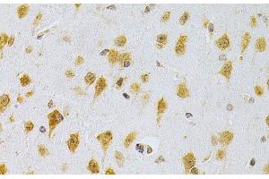 Immunohistochemistry of paraffin-embedded Mouse brain using MDM2 Polyclonal Antibody at dilution of 1:200 (40x lens). (MDM2 抗体)