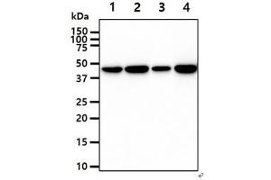 The cell lysates (40ug) were resolved by SDS-PAGE, transferred to PVDF membrane and probed with anti-human CKB antibody (1:1000). (CKB 抗体)