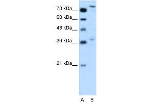 WB Suggested Anti-NFE2L3 Antibody Titration:  0. (NFE2L3 抗体  (Middle Region))