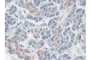 Immunohistochemistry (IHC) image for anti-Tachykinin Receptor 2 (TACR2) (AA 92-290) antibody (ABIN7432214)