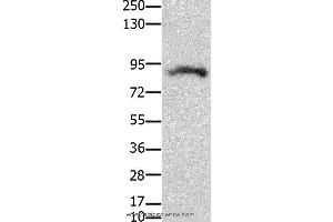 Western blot analysis of Mouse brain tissue, using KCNH2  Polyclonal Antibody at dilution of 1:100 (KCNH2 抗体)