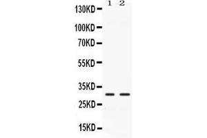 Western blot analysis of CA3 expression in rat cardiac muscle extract ( Lane 1) and mouse cardiac muscle extract ( Lane 2). (CA3 抗体  (AA 14-235))