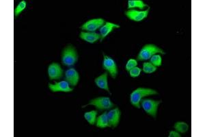 Immunofluorescence staining of Hela cells with ABIN7152141 at 1:100, counter-stained with DAPI. (PERK 抗体  (AA 115-330))