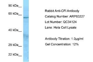 Western Blotting (WB) image for anti-Complement Factor I (CFI) (N-Term) antibody (ABIN2789418)