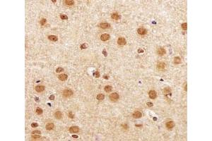 IHC analysis of FFPE mouse brain section using SIRT1 antibody at 1:25. (SIRT1 抗体  (AA 566-601))