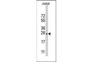 Western blot analysis of CLDN1 Antibody (Loop1) in Jurkat cell line lysates (35ug/lane). (Claudin 1 抗体  (Loop 1))