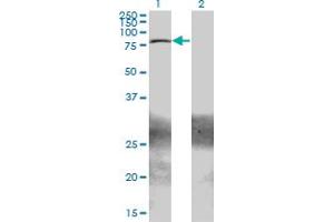 Western Blot analysis of ZBTB33 expression in transfected 293T cell line by ZBTB33 monoclonal antibody (M01A), clone 2B2. (ZBTB33 抗体  (AA 564-673))