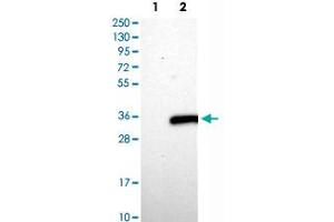 Western Blot analysis of Lane 1: negative control (vector only transfected HEK293T cell lysate) and Lane 2: over-expression lysate (co-expressed with a C-terminal myc-DDK tag in mammalian HEK293T cells) with ASB7 polyclonal antibody . (ASB7 抗体)