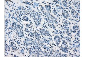 Immunohistochemical staining of paraffin-embedded breast tissue using anti-PSMA7 mouse monoclonal antibody. (PSMA7 抗体)