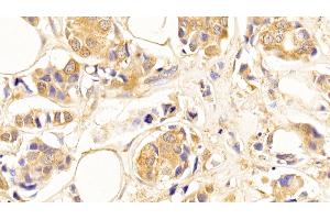 Immunohistochemistry (IHC) image for anti-Tubulin, beta (TUBB) (AA 170-419) antibody (ABIN7428962)