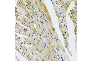 Immunohistochemistry of paraffin-embedded mouse heart using COPB2 antibody (ABIN5974232) at dilution of 1/100 (40x lens). (COPB2 抗体)