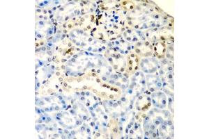 Immunohistochemistry of paraffin-embedded mouse kidney using DCTD antibody  at dilution of 1:200 (40x lens). (DCMP Deaminase (DCTD) (AA 1-178) 抗体)