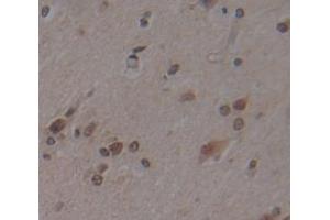 IHC-P analysis of Human Tissue, with DAB staining. (JNK 抗体  (AA 145-419))