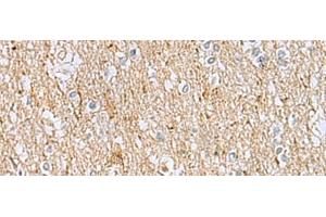Immunohistochemistry of paraffin-embedded Human brain tissue using LRRC49 Polyclonal Antibody at dilution of 1:40(x200) (LRRC49 抗体)