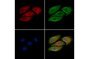 ABIN6256588 and ABIN6267381 staining Hela cells(4h of LPS treatment) by IF/ICC. (BRAF 抗体  (pThr599))